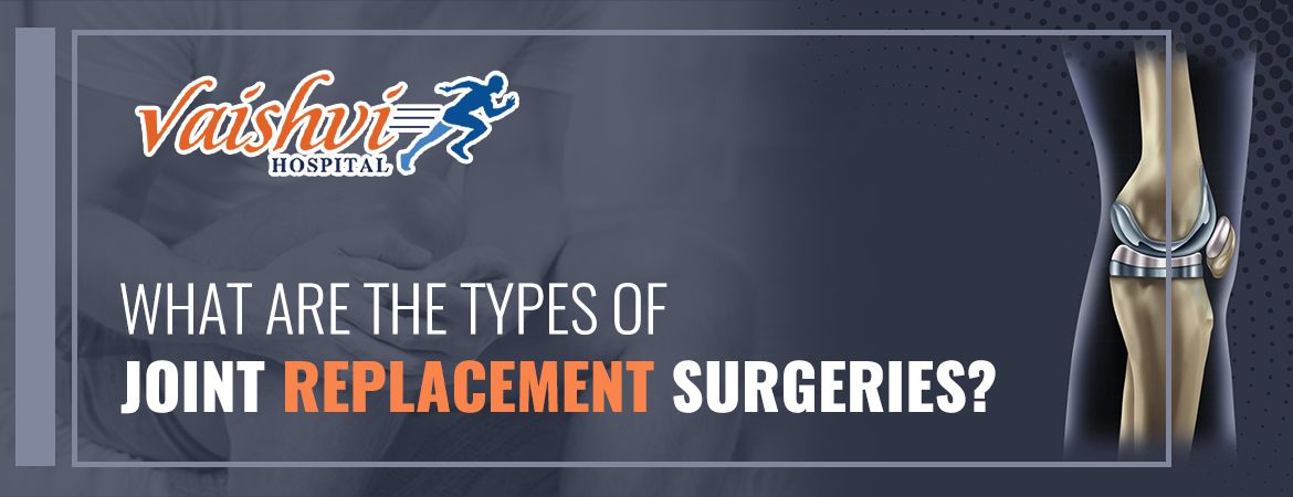 What is the Subvastus Approach to Total Knee Replacement?