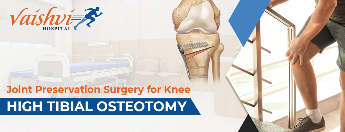 Joint Preservation Surgery for Knee - HIGH TIBIAL OSTEOTOMY